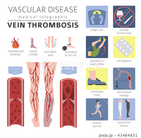 Vascular diseases. Vein thrombosis infographic Vascular diseases. Vein thrombosis infographic 43464831