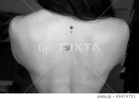 Moles on back of woman, black and white colors 43474751