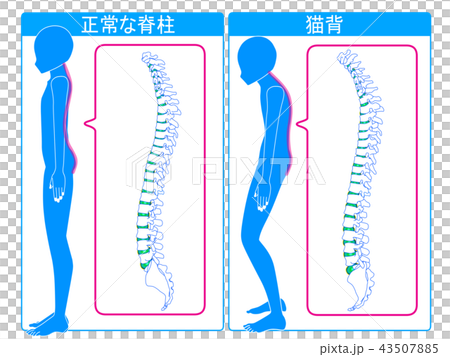 正常脊柱和貓高度比較 正常脊柱和貓高度比較 43507885
