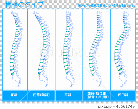骨架類型1(藍色) 骨架類型1(藍色) 43561749