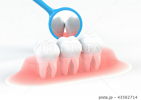 歯科衛生のイラストCG 歯科衛生のイラストCG 43562714