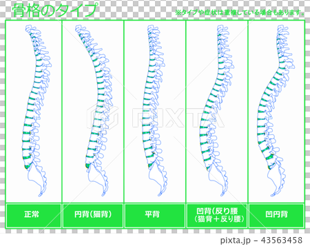 骨架類型5（綠色） 43563458