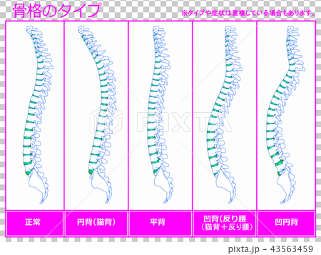Skeleton type 4 (pink)) 43563459