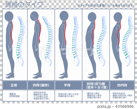 骨格のタイプ　脊柱あり（グレー） 43566986