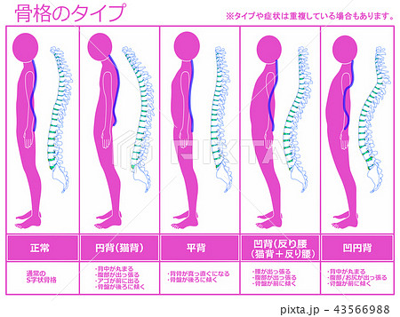 骨格のタイプ 脊柱あり(ピンク) 骨格のタイプ 脊柱あり(ピンク) 43566988