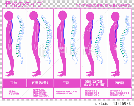 骨格のタイプ 脊柱あり(ピンク) 骨格のタイプ 脊柱あり(ピンク) 43566988