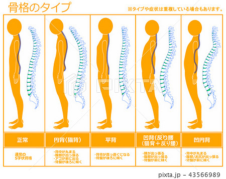 骨格のタイプ　脊柱あり（オレンジ） 43566989