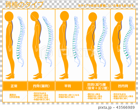 骨格のタイプ　脊柱あり（オレンジ） 43566989