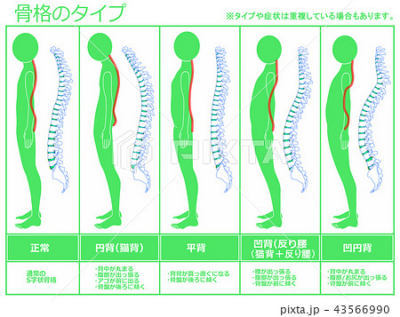 骨格のタイプ　脊柱あり（グリーン） 43566990