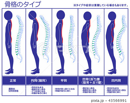 骨格のタイプ　脊柱あり（ネイビー） 43566991