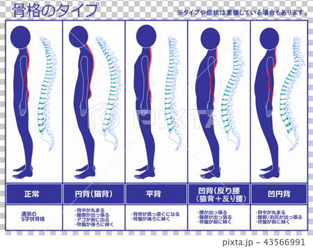骨格のタイプ　脊柱あり（ネイビー） 43566991