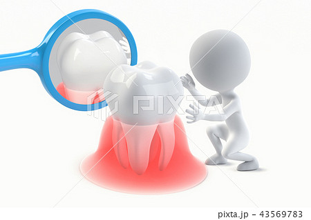 歯の健康状態のチェックのイラストCG 歯の健康状態のチェックのイラストCG 43569783