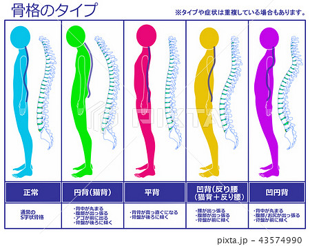 骨格のタイプ 脊柱あり(カラー) 骨格のタイプ 脊柱あり(カラー) 43574990