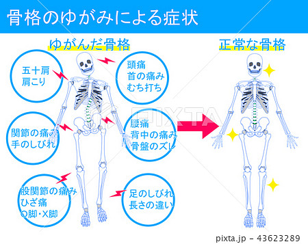 骨格のゆがみによる症状3 43623289