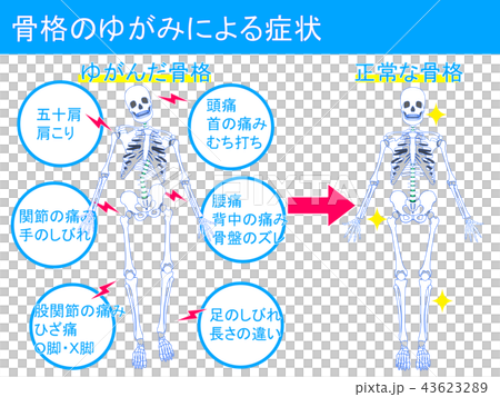 骨格のゆがみによる症状3 43623289
