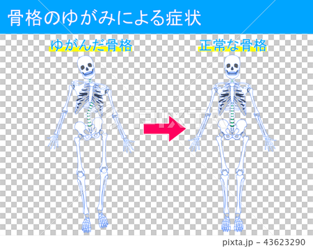 骨格のゆがみによる症状4 43623290