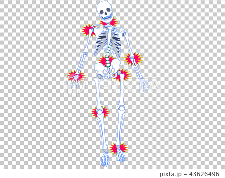 骨架扭曲側3 43626496