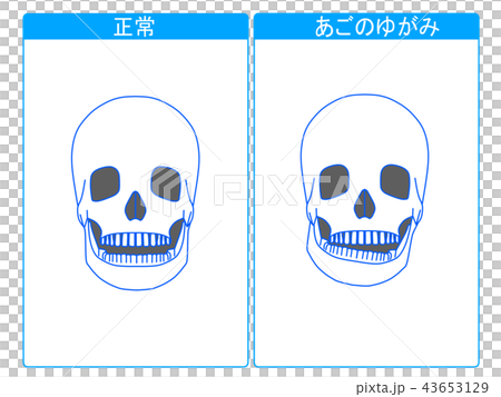 正常とあごのゆがみの比較2 43653129