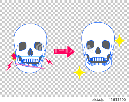 下頜症狀改善 43653300