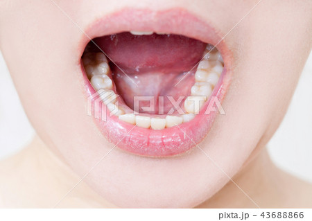 女性の歯 43688866