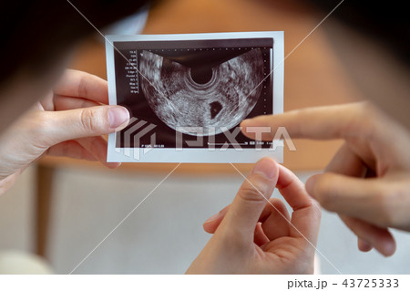 夫婦 妊娠 エコー写真 夫婦 妊娠 エコー写真 43725333