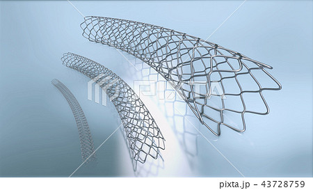 three metal stents for implantation three metal stents for implantation 43728759