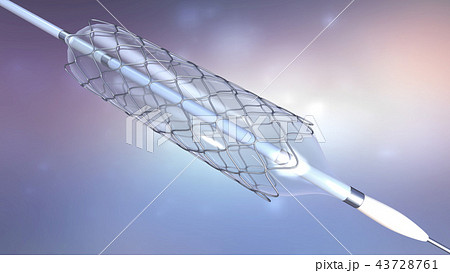catheter for stent implantation into blood vessels 43728761