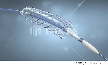 catheter for stent implantation into blood vessels catheter for stent implantation into blood vessels 43728762