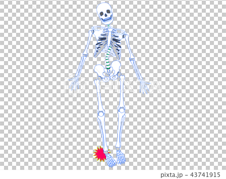 足首捻挫のイラスト素材