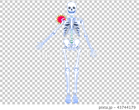 肩関節脱臼 43744179