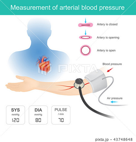 instrument used to measure arterial blood pressure