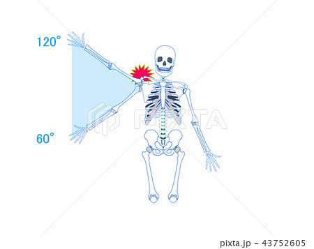 肩関節の痛み 43752605