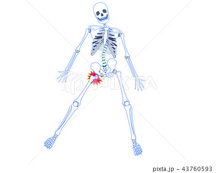 股関節の負傷 股関節の負傷 43760593