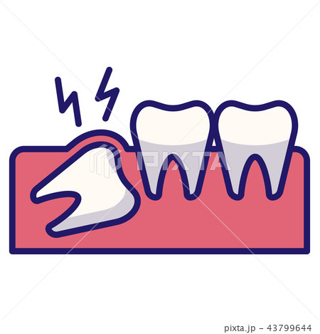 Wisdom tooth LineColor Wisdom tooth LineColor 43799644