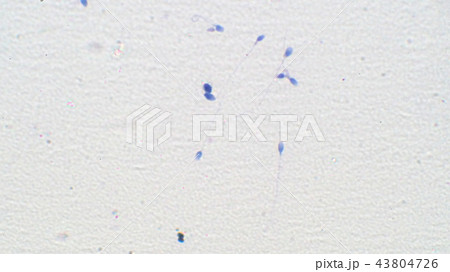 精子の顕微鏡写真 精子の顕微鏡写真 43804726