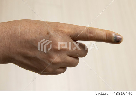 医療 生活 事故 43816440