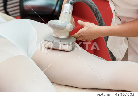 Woman having anti cellulite lpg massage Woman having anti cellulite lpg massage 43867003