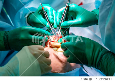 Surgeon and his assistant performing cosmetic surgery on nose in hospital operating room. Nose Surgeon and his assistant performing cosmetic surgery on nose in hospital operating room. Nose 43949841