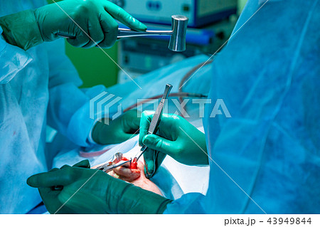 Surgeon and his assistant performing cosmetic surgery on nose in hospital operating room. Nose 43949844