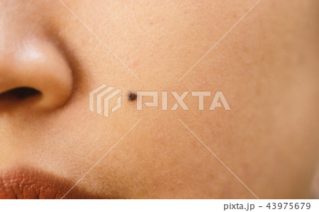 Close Up' Mole on the face of a woman. 43975679