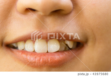 The teeth of women are unattractive teeth. 43975680