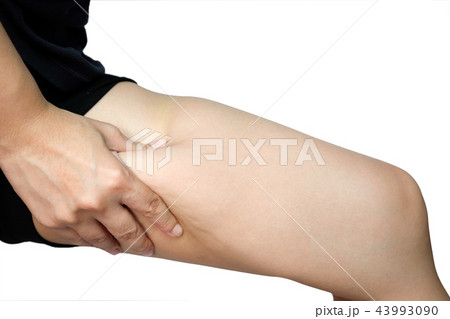 Female legs thighs with cellulite Female legs thighs with cellulite 43993090
