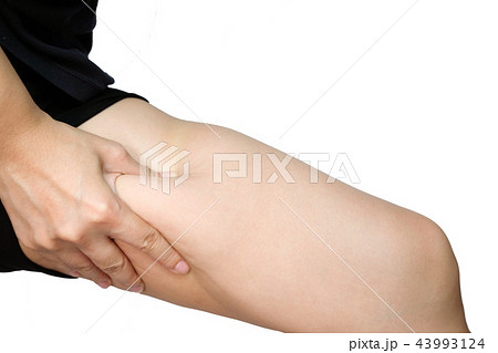 Female legs thighs with cellulite Female legs thighs with cellulite 43993124