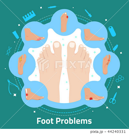 Foot Problems Flat Composition 44240331
