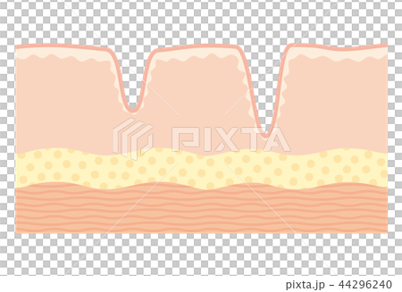 皮膚的橫截面 皮膚的橫截面 44296240