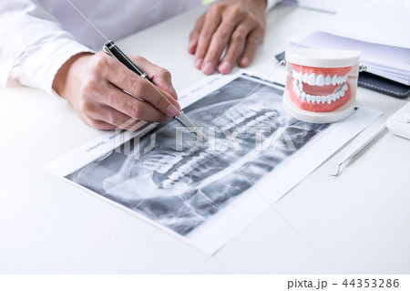 Male doctor or dentist writing report working with tooth x-ray f 44353286