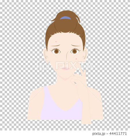 A woman who has had a pimple on her face 44411771