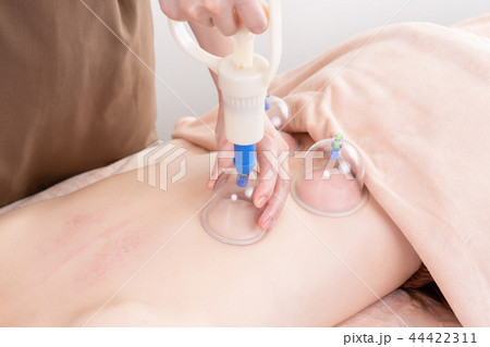 かっさ、カッピング、カップ、セラピスト、アロマセラピー、マッサージ、フェイシャル、フェイシャルマッサ 44422311