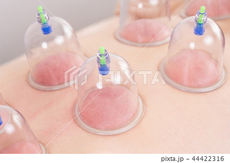 かっさ、カッピング、カップ、セラピスト、アロマセラピー、マッサージ、フェイシャル、フェイシャルマッサ 44422316