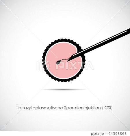 fertility reproduction of ovum and spermatozoon ICSI fertility reproduction of ovum and spermatozoon ICSI 44593363